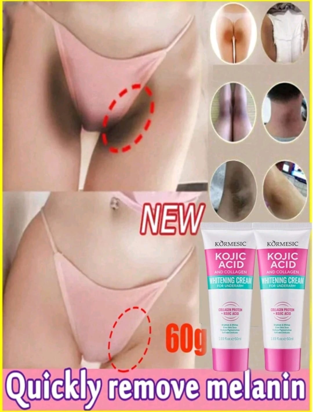 1pc Underarm Whitening Cream To Remove Underarm, Knee And Elbow Darkness. Contains Plant Essence And Collagen To Whiten, Moisturize And Brighten The Skin.