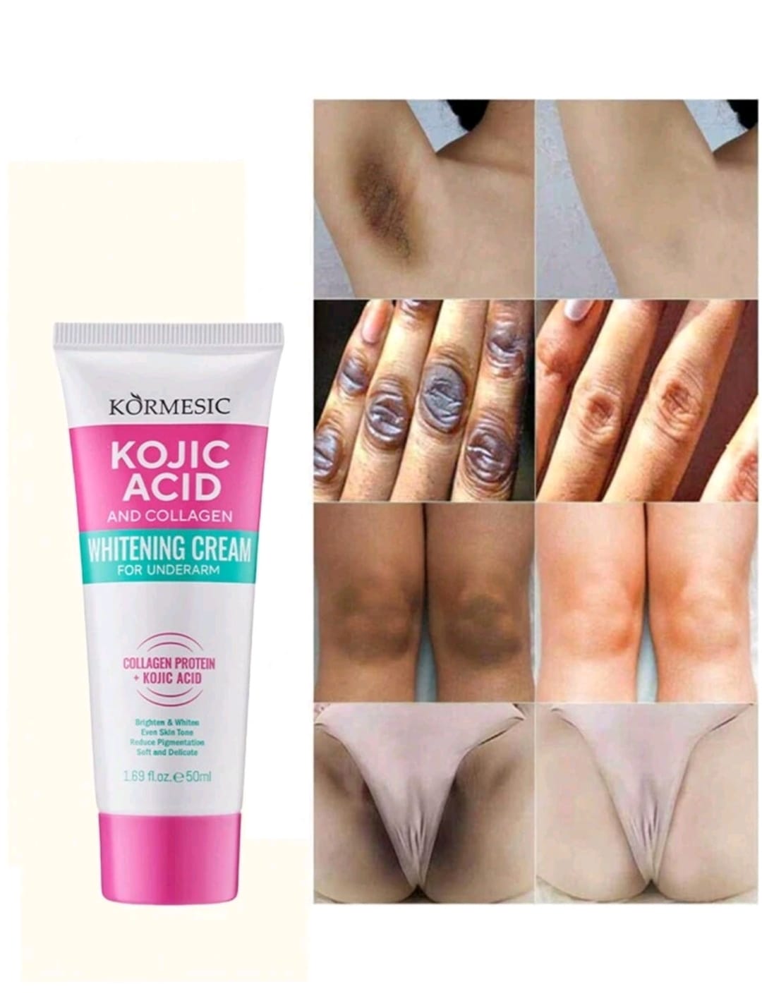 1pc Underarm Whitening Cream To Remove Underarm, Knee And Elbow Darkness. Contains Plant Essence And Collagen To Whiten, Moisturize And Brighten The Skin.
