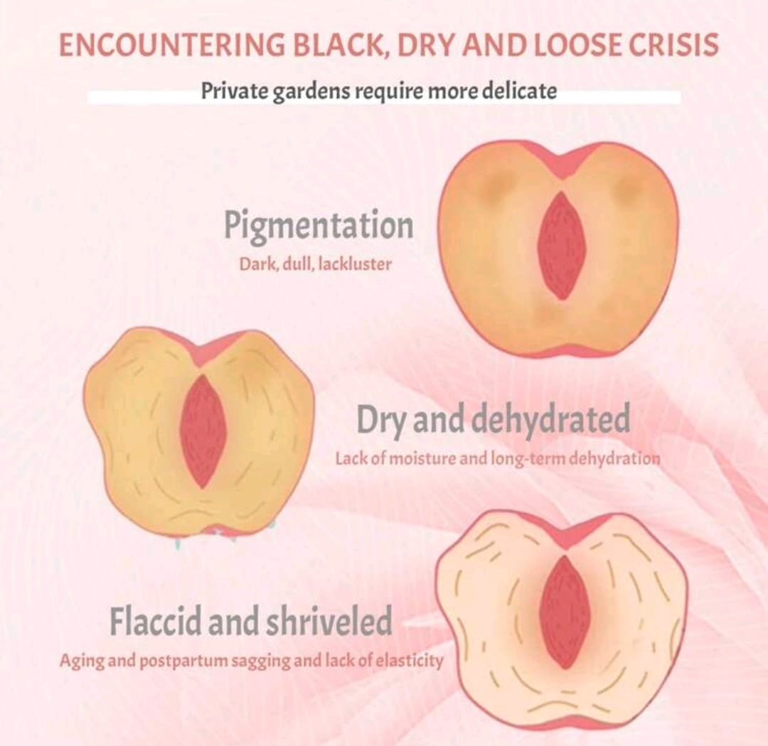10ml Intimate Care Oil, Moisturizing & Firming Oil, Nourishing & Hydrating, Brightening & Plumping, Improving Darkening & Laxity, More Tight & Moisturized, Eliminating Odor, Romantic Fresh Fragrance, Bringing Back Youth